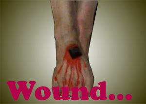 Wound
