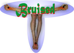 Bruised